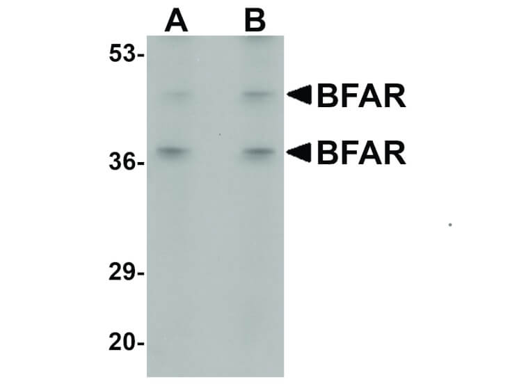Western Blot of BFAR Antibody