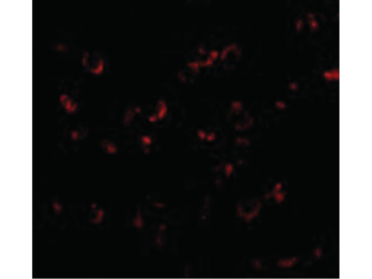 Immunofluorescence of BICD1 Antibody