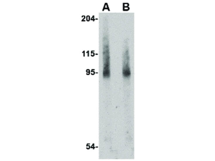 Western Blot of BICD2 Antibody