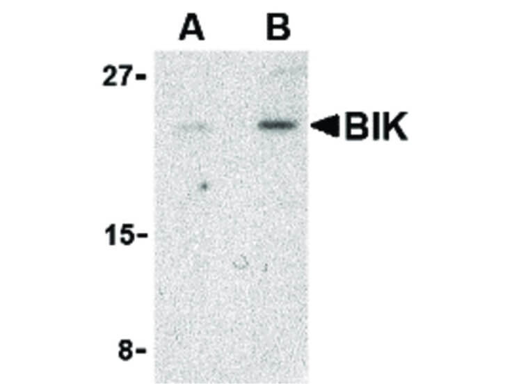 Western Blot of Bik Antibody