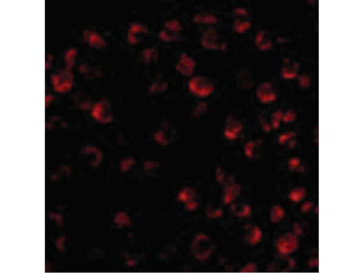 Immunofluorescence of Bim Antibody