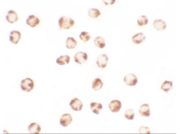 Immunocytochemistry of BIM EL