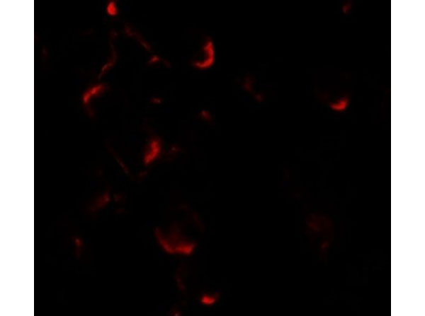 Immunofluorescence of BIM EL
