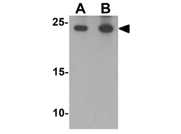 Western blot of Bim EL