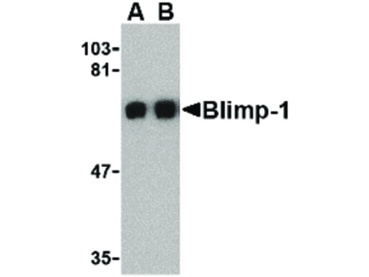 Western Blot of Blimp-1 Antibody