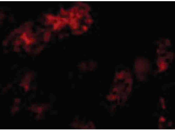 Immunofluorescence of Bmf Antibody