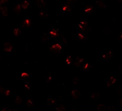 Immunofluorescence of BMP15.