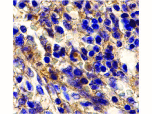 Immunohistochemistry of Bonzo Antibody