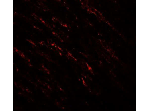 Immunofluorescence of B-raf