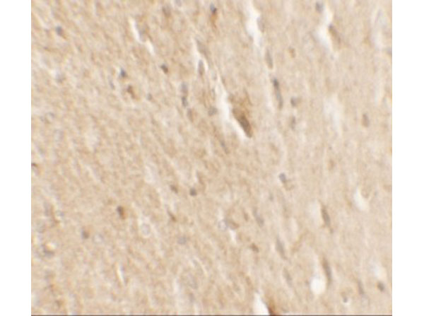 Immunohistochemistry of B-raf