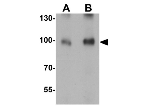 Western Blot of B-raf