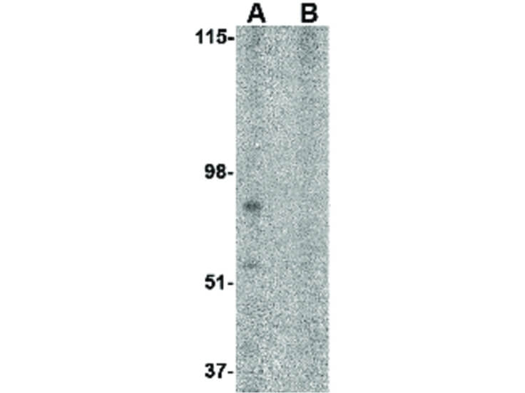 Western Blot of BRCC45 Antibody
