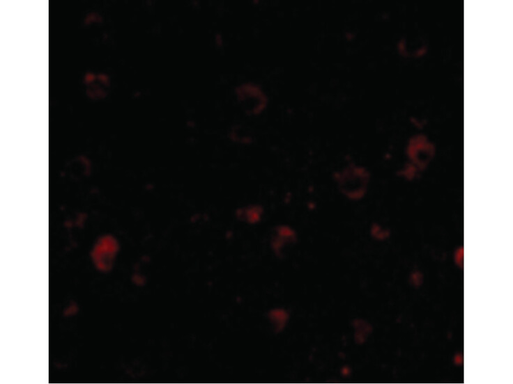 Immunofluorescence of BRSK1 Antibody