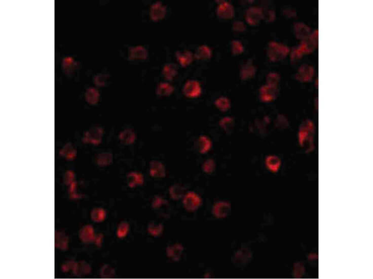 Immunofluorescence of BTK Antibody