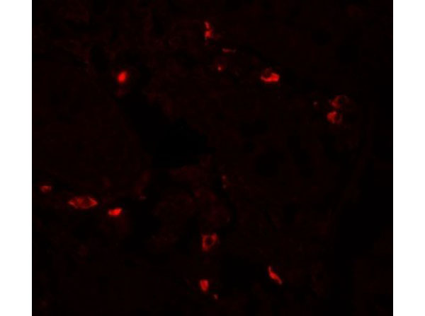 Immunofluorescence of BTLA