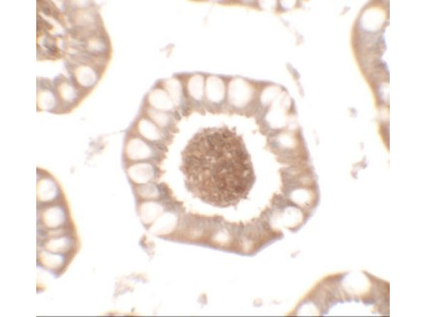 Immunohistochemistry of BTLA