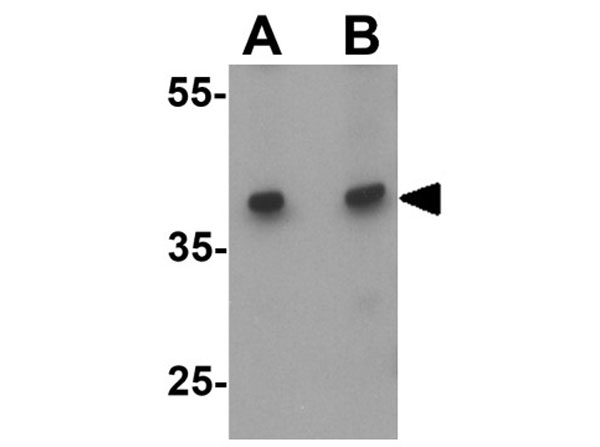Western blot of BTLA