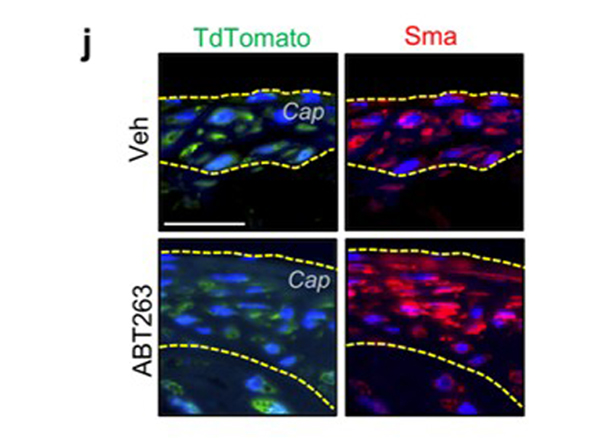 Immunofluorescence using FITC RFP