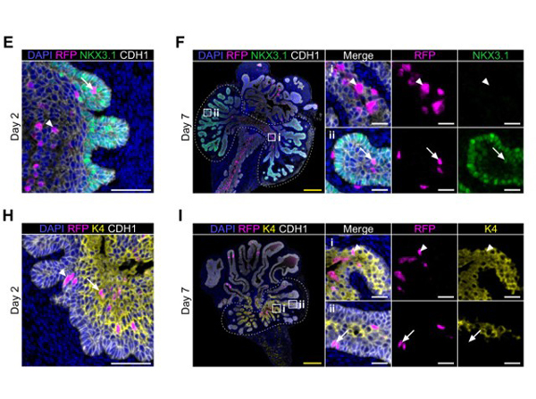Immunofluorescence using FITC RFP