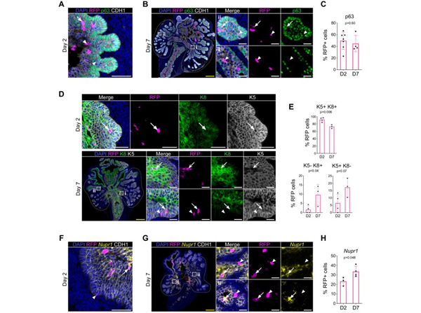 Immunofluorescence using FITC RFP
