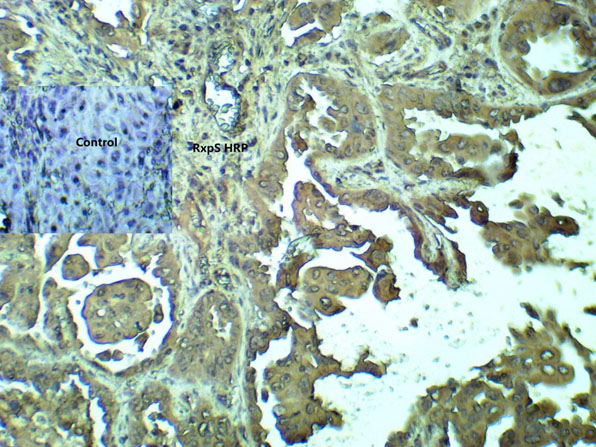 Immunohistochemistry of Anti-PhosphoSerine