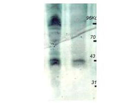 Anti-PhosphoThreonine (pT) Antibody - Western Blot