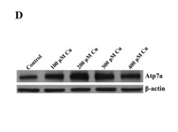 Beta Actin Antibody Peroxidase Conjugated
