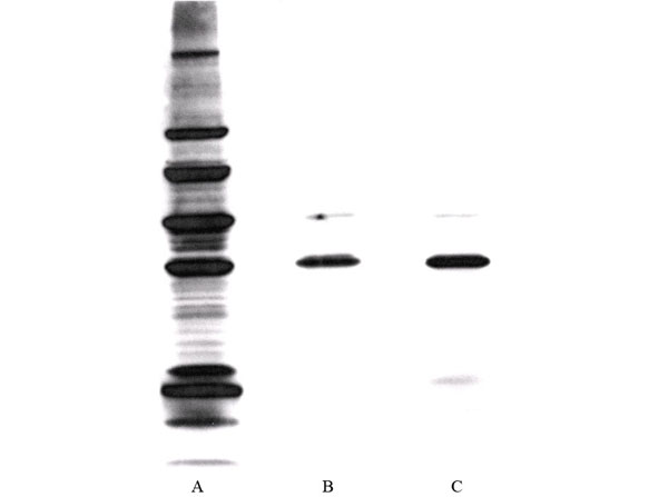 Western Blot of Anti-Lysine Methylated