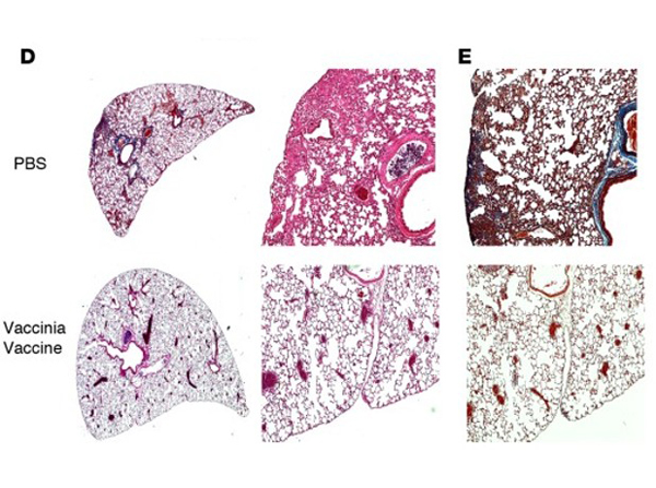 Immunohistochemistry using Collagen Type 1