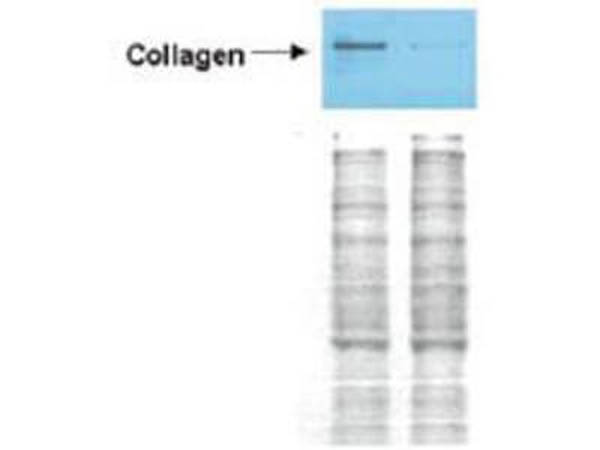 Anti-Collagen I Anitbody - Western Blot