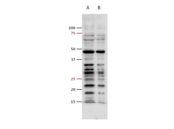 Western Blot of Anti-PhosphoTyrosine