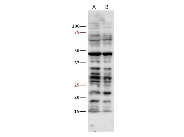 Western Blot of Anti-PhosphoThreonine