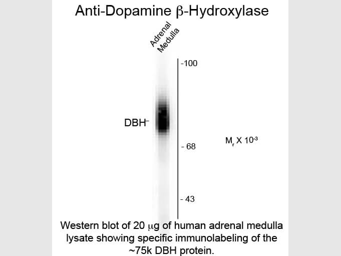 Western Blot of Anti-Dopamine ß-Hydroxylase (Sheep) Antibody - 600-601-D27