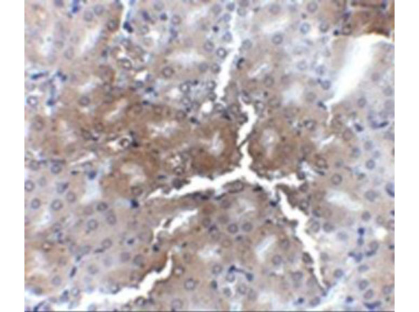 Immunohistochemistry of AP2M1