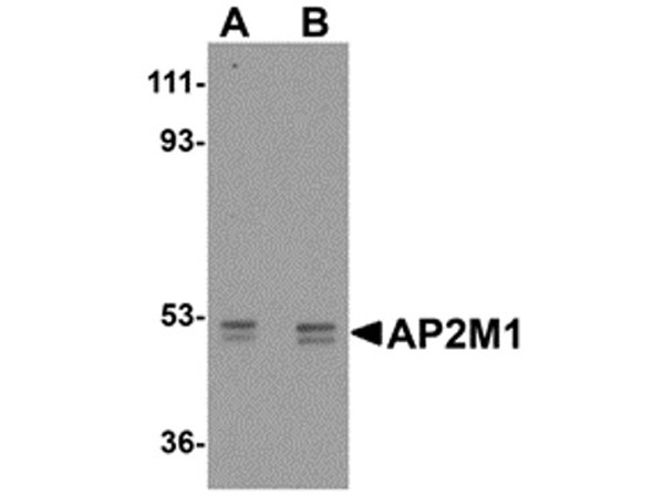 Western blot of AP2M1