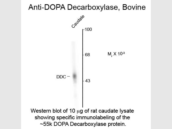 Western blot of DOPA Decarboxylase Bovine Antibody