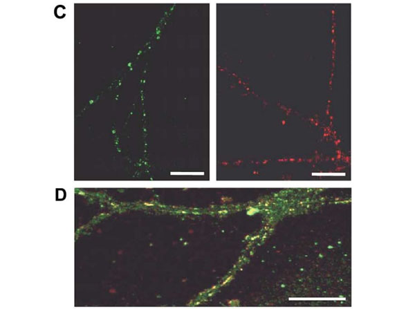 Immunofluorescence using Goat Anti-Guinea Pig IgG Texas Red