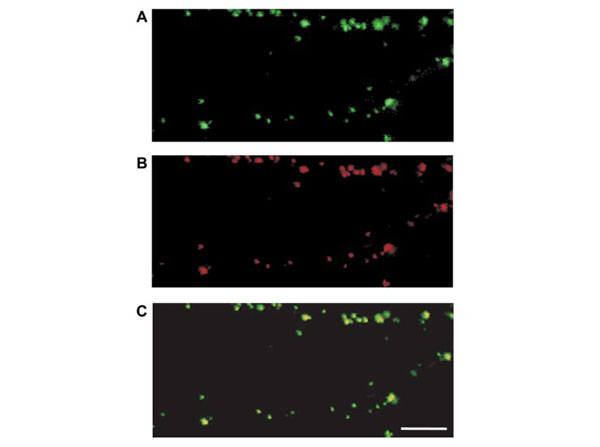 Immunofluorescence using Goat Anti-Guinea Pig IgG Texas Red