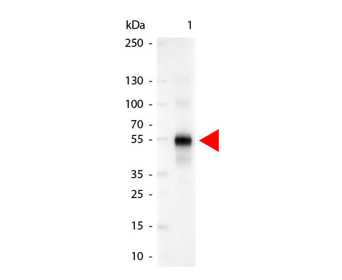 Human IgG gamma Antibody Alkaline Phosphatase