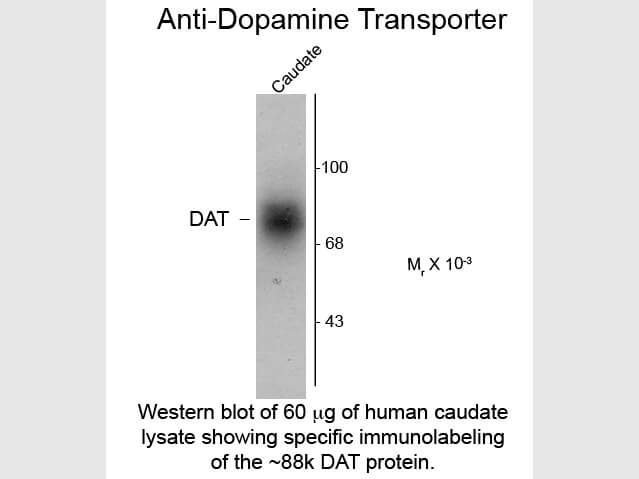 Western blot of Dopamine Transporter C-Terminus Human Antibody