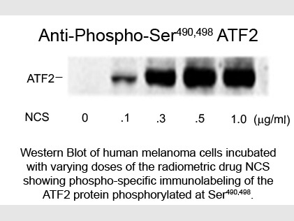 Western Blot of Anti-ATF2 pS490/pS498 (Rabbit) Antibody - 609-401-D11