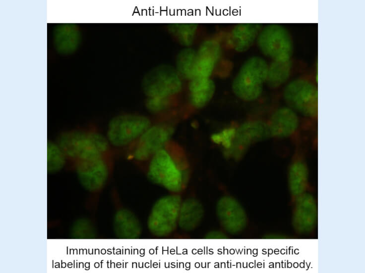 Immunostaining of Anti-Nuclei (Mouse) Antibody - 209-301-D99