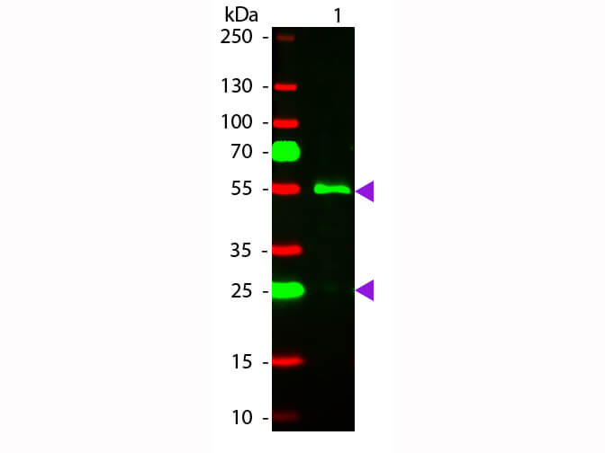 WBM - Human IgG (gamma chain) Antibody Rhodamine Conjugated