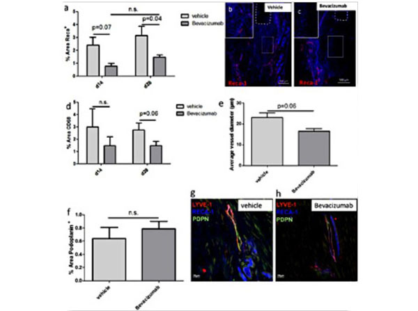 Immunohistochemistry using Donkey Anti-Human IgG Texas Red