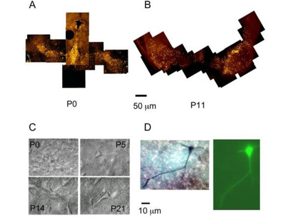 Immunofluorescence using goat anti-mouse IgG rhodamine