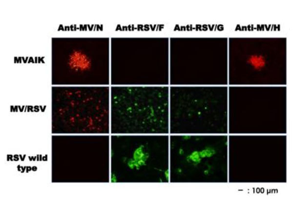 Immunofluorescence using goat anti-mouse IgG rhodamine
