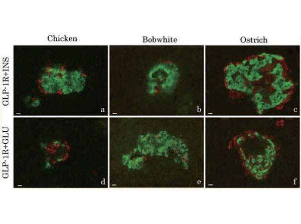 Immunofluorescence using Goat Anti-Rabbit IgG Rhodamine