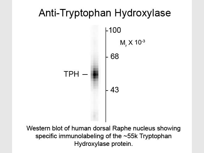 Western blot of Tryptophan Hydroxylase Antibody