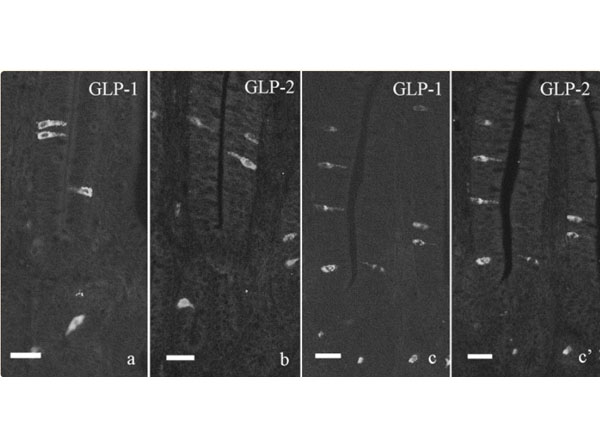 Immunofluorescence results with Donkey Anti-Rabbit IgG Rhodamine