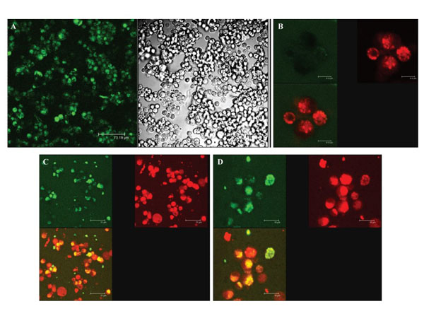 Immunofluorescence results with Donkey Anti-Rabbit IgG Rhodamine